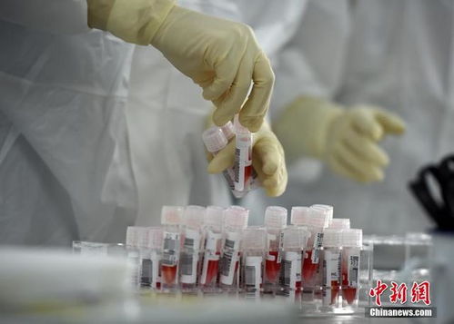 探訪新冠肺炎病毒核酸檢測服務(wù)